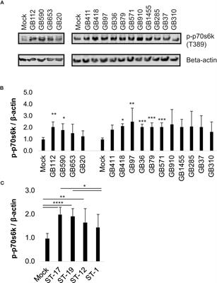 The PI3K-Akt pathway is a multifaceted regulator of the macrophage response to diverse group B Streptococcus isolates